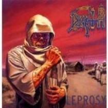 Leprosy