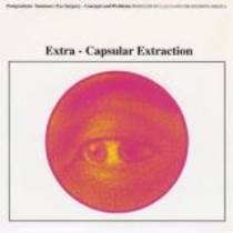 Extra-Capsular Extraction