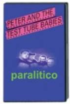 Paralitico