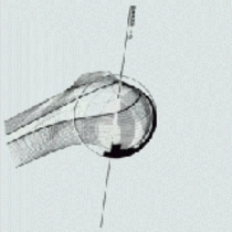 Split avec Seethings