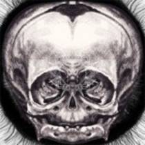 s/t - EP